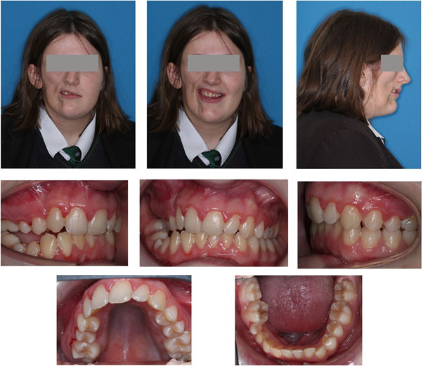 rare diseases of the teeth